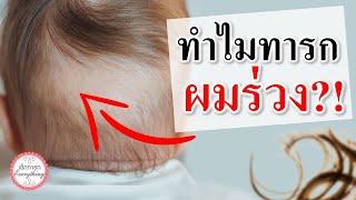 อาการทารก : ทำไมทารกจึงผมร่วง? | ผมทารก | เด็กทารก Everything