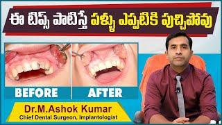 దంత సమస్యలు| Tips to Prevent Dental Cavities in Telugu | Dental Care Tips | Eledent Dental Hospitals