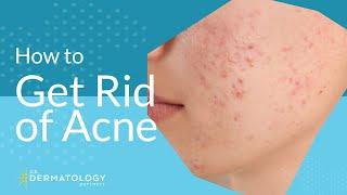 Acne Treatment - Explained by Dermatologist