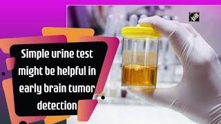 Simple urine test might be helpful in early brain tumor detection