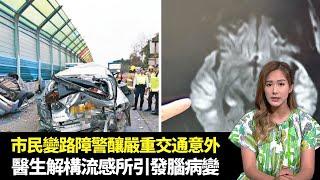 東張西望｜市民座駕變人肉路障警釀嚴重交通意外｜醫生解構流感所引發腦病變｜年桔購買須知朱砂砂糖有何特別｜朱凱婷 陳庭欣 區永權 朱智賢