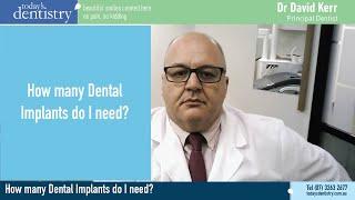 All on 4 explained - How many Dental Implants can you get?