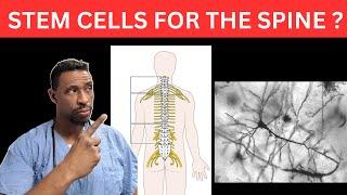 Spinal pain & Stem Cells doing it better in 2024 : New concepts and Better options