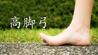 《高脚弓》你知多少？