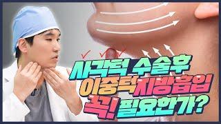 사각턱수술 해도 효과가 없으면 지방흡입을 같이 해야됩니다 | 에이비성형외과