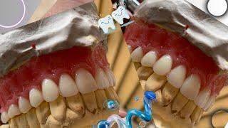 Wax carving of denture. Make denture looks good #dental #umair toothfairy @Umairazeem8553