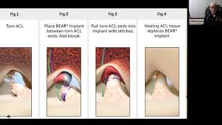 Soft tissue and Fascia, with Dr Tom Hyde