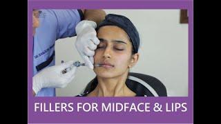 Fillers for Midface & Lips - Dr. Sanjeev  Nelogi