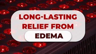 Long-lasting relief from edema | Nation Health | Lisa King RPh