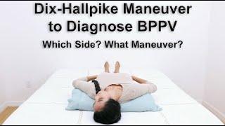 Dix Hallpike Maneuver to Diagnose BPPV - What Side and What Type for Proper Treatment