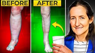 URGENT! Barbara O'Neill EXPOSES The Instant FIX for Swollen Feet & Legs