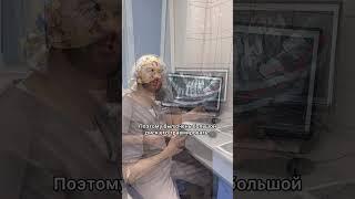 Рассказываем про сложное удаление зуба мудрости