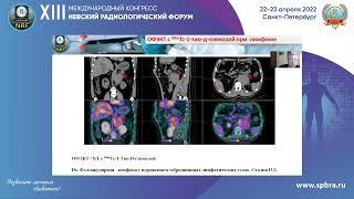 ЯДЕРНАЯ МЕДИЦИНА В ДИАГНОСТИКЕ И МОНИТОРИНГЕЛЕЧЕНИЯ ОПУХОЛЕЙ РАЗЛИЧНЫХ ЛОКАЛИЗАЦИЙ