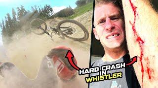 HARD CRASH ON MY DOWNHILL BIKE IN WHISTLER BIKE PARK!