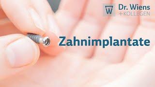 Zahnimplantate: Das sollten Sie wissen!