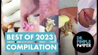 Dr Pimple Popper's Best of 2023 Compilation of Popaholic FAVORITES!