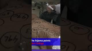 location of hijama point by dr bilal | BHN STUDIO