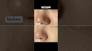 모공계의 에르메스 #미친모공팩 #홈케어 #모공관리