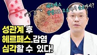 헤르페스 그렇게 간단한 질환 아닙니다 | 비뇨기과의사가 말하는 성병 | 헤르페스 곤지름 원인 증상