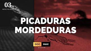 Picaduras y Mordeduras - ENARM