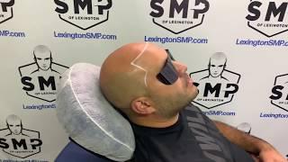 SMP Of Lexington - Scalp Micropigmentation - Hair Tattoo