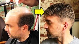 NON-SURGICAL HAIR REPLACEMENT SYSTEM FOR MEN | HAIR TRANSFORMATION