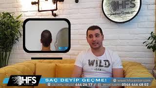 SAÇ EKİMİ SONRASI SAÇ SİMÜLASYONU