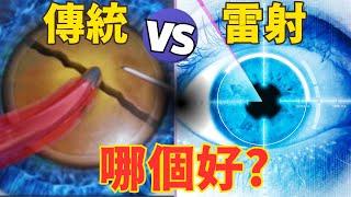 飛秒雷射白內障手術 vs 傳統手術哪個好? 優缺點揭露! 雷射值得多花錢嗎？