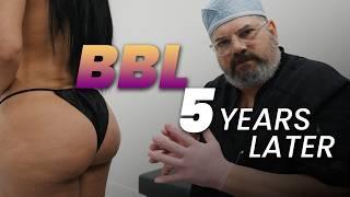 BBL Results 5 Years Later