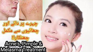 Dark spots treatment|dark circles & pimples cream|acne's treatment|beauty cream, melasma cream