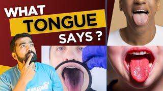 जुबान का रंग देख के पता करो बीमारी | Tongue Color & Disease 