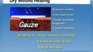 Why Moist Wound Healing?