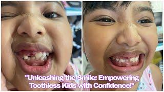 "Unleashing the Smile: Empowering Toothless Kids with Confidence!"| Yang Fam️