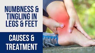 Leg & Foot Numbness & Tingling: Diagnosis & Treatment