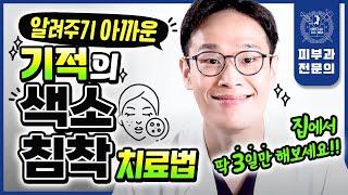 피부과 안 가고 정말 쉽게 집에서 색소침착 없애는 법 | 착색 여드름자국 홈케어