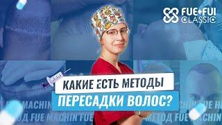 Какой метод пересадки волос лучше?