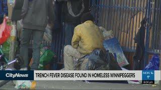 Trench fever afflicting homeless in Winnipeg