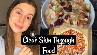 WHAT I EAT FOR CLEAR SKIN || Supplements, COMFORT FOOD EDITION, Anti Acne Diet + Taking it easy!!!