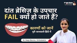 Why Braces Treatment Fails | Must Watch Video Before Orthodontic Treatments - Dr Pooja Sharma Agra