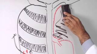 Lobectomy of Lung -- Minimally Invasive Approach to Lung Cancer Surgery