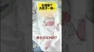 试管代孕机构微信：ivf553  奶声奶气的维吾尔族宝宝，还有尖尖的小下巴#IVF#上海#广州#代孕#单身代孕#代孕机构#上海#香港#澳门#深圳#单身试管#福建#苏州#试管#石家庄#北京#广州试管机构