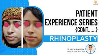 Nose Reshaping: Patient Journeys through Rhinoplasty at The Venkat Center Bangalore