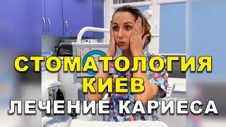 Стоматология Киев | Лечение кариеса   #Shorts