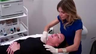 The Vi Peel at Sonata Aesthetics