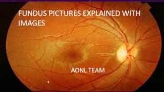 Fundus images explained by an ophthalmologist