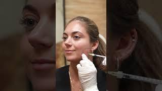 Masseter Botox
