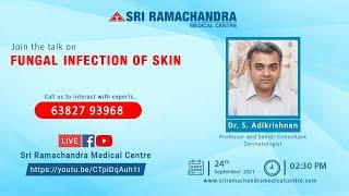 FUNGAL INFECTION OF SKIN Prevention and Treatment | Sri Ramachandra Medical Center