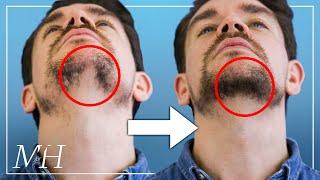 How To Fix Your Patchy Beard… Fast!