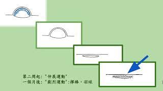 狐臭小教室- 第十一堂 : 認識術後"短暫"的拉扯緊繃感?