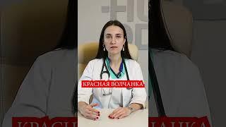 Системная Красная Волчанка - симптомы, признаки. Болезнь Либмана-Сакса, СКВ